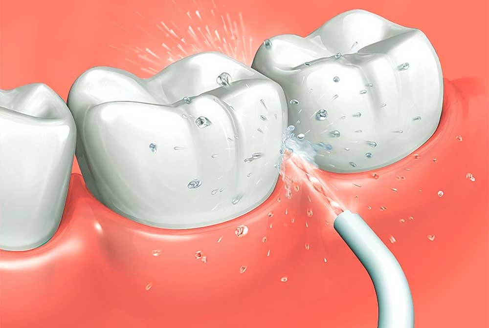 Irrigador Oral Electrico Recargable